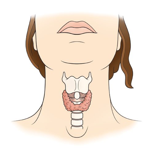В каких случаях удаляют щитовидную железу у женщин
