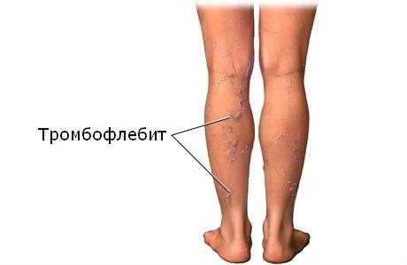 Причины онемения ноги